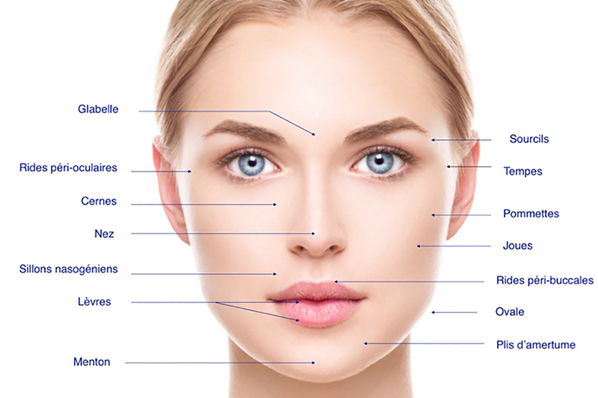 Injection d'acide hyaluronique dans le visage